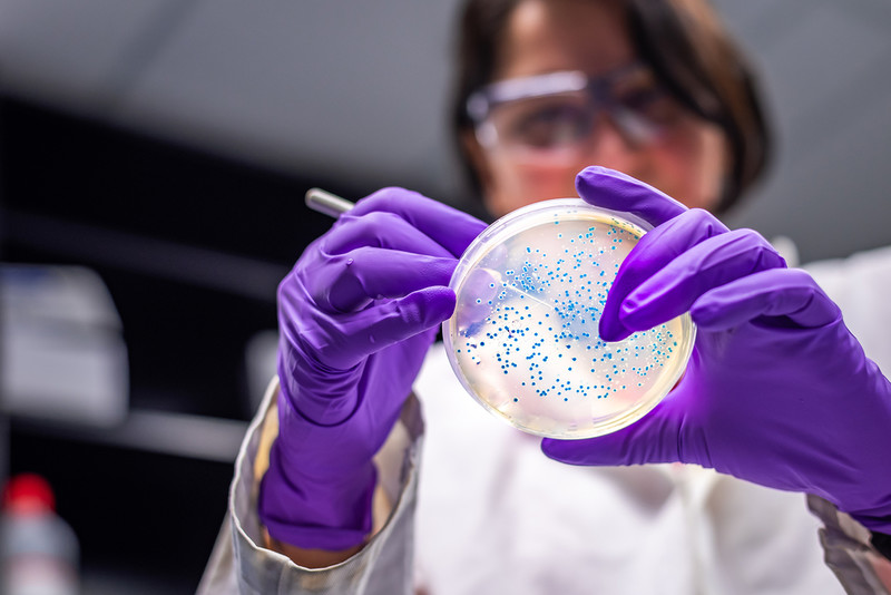 Superbugs could kill millions more and cost $2tn a year by 2050, models show