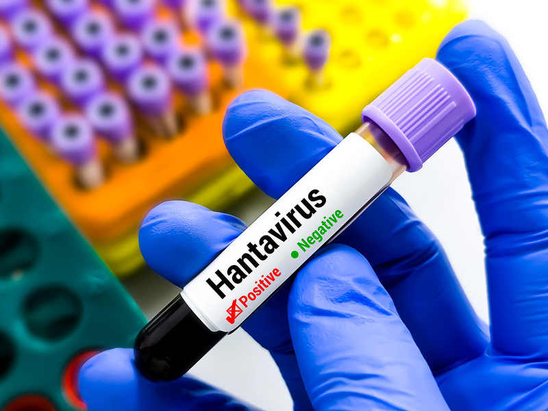 "The Times": Hantavirus is a sign that we must be prepared for pandemics