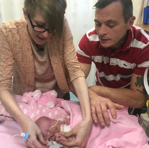 Vanellope Hope Wilkins, baby born with heart outside body, first in UK to survive