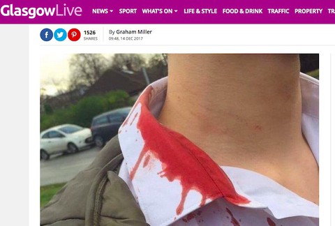 Atak na polskiego ucznia kastetem w szkockiej szkole 