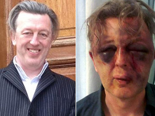 University law lecturer face disfigured after attack by burglars