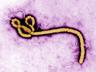Ebola jako broń biologiczna? "To mało prawdopodobne"