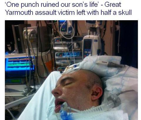'One punch ruined our son's life''