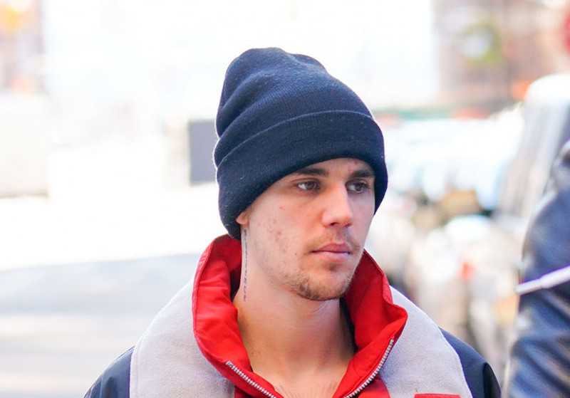 Justin Bieber wyznał, że choruje na boreliozę
