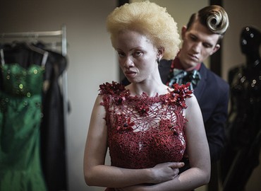 Modelka albinoska sensacją wybiegów mody!
