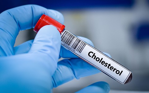 Zdrowie: ApoB lepszym wskaźnikiem ryzyka niż cholesterol
